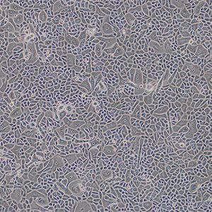 Human Conjunctival Epithelial Cells