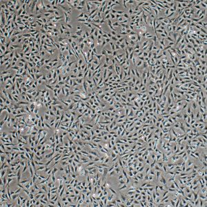 Immortalized Human Corneal Epithelial Cell Line