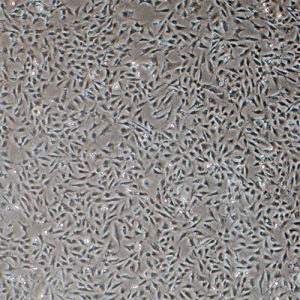 Human Corneal Epithelial Cells - Innoprot Ocular Cell System