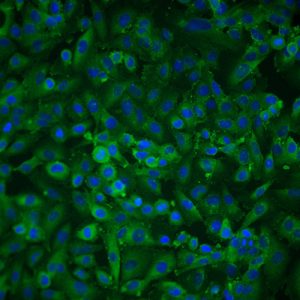 Human Corneal Epithelial Cells
