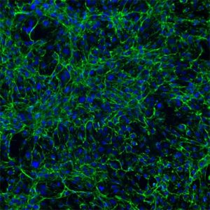 Human Cardiac Fibroblasts
