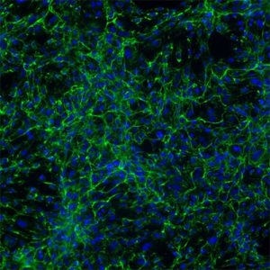 Immortalized Human Cardiac Fibroblasts
