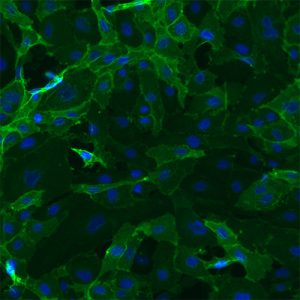 Immortalized Human Dermal Microvascular Endothelial Cells