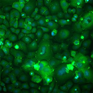 Human Epidermal Keratinocytes