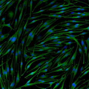 Human Epidermal Melanocytes