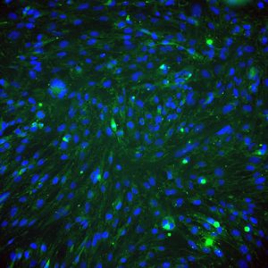 Human Adipose-derived Mesenchymal Stem Cells