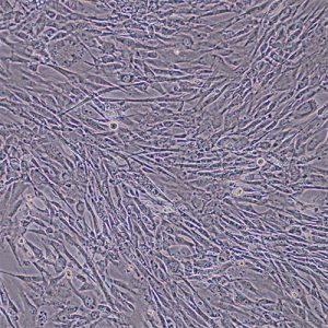 Human Preadipocytes