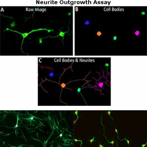 Neurite Outgrowth Assay