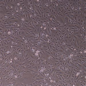 Immortalized Human Retinal Endothelial Cells