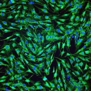 Immortalized Human Astrocytes