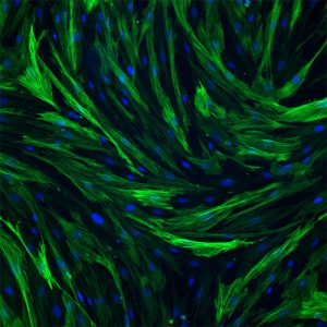 Immortalized Human Keratocytes