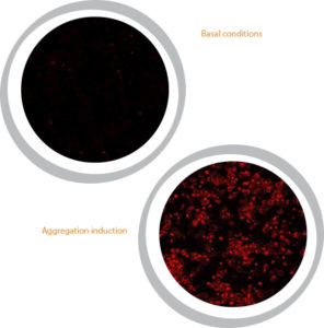SOD1 aggregation assay