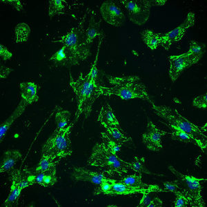 Immortalized Human Small Intestine Fibroblasts