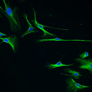 Immortalized Human Meningeal Cells