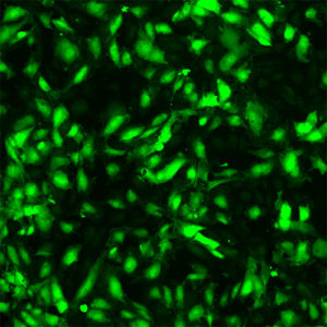 Green Fluorescent Immortalized HAEC