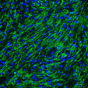 Immortalized Human Colonic Fibroblasts