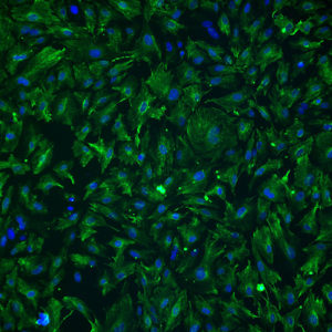 Immortalized Human Renal Mesangial Cells