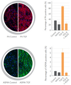 Liver Fibrosis Assay