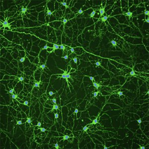Rat Spinal Motor Neurons