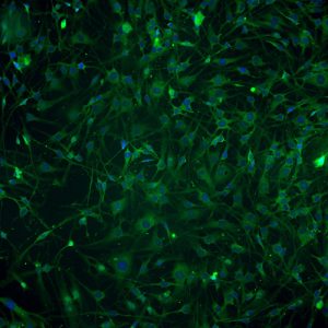 Immortalized Human Retinal Pericytes