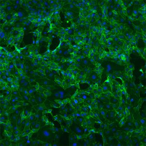 Immortalized Human Pancreatic Microvascular Endothelial Cells