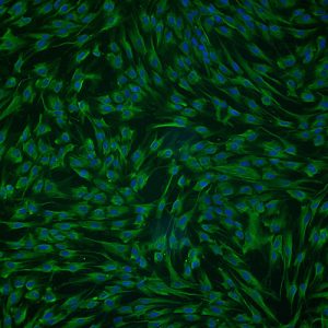 Immortalized Human Retinal Astrocytes