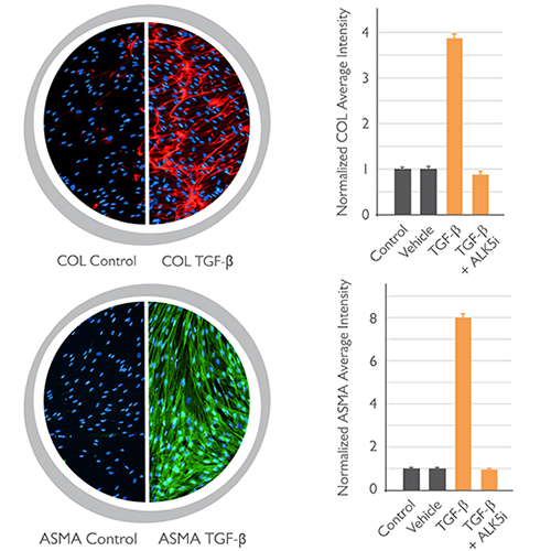 Skin Fibrosis Assay