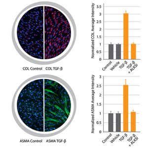 Uterine Fibrosis Assay