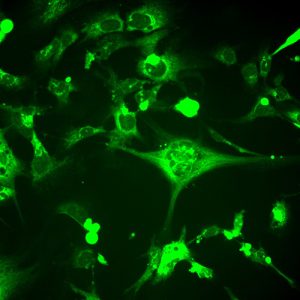 APOE4 Expressing Cell Lines