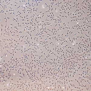 Immortalized Human Osteoblasts