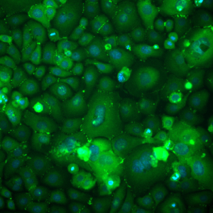 Immortalized Human Epidermal Keratinocytes
