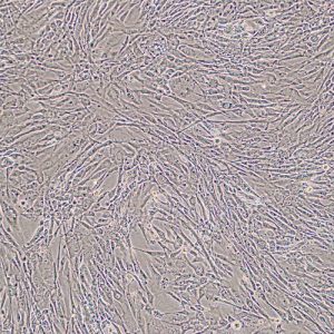 Immortalized Human Preadipocytes