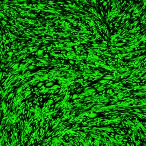 Immortalized Human Skeletal Muscle Myoblasts