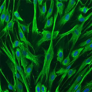Monkey Aortic Smooth Muscle Cells