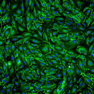 Immortalized Human Splenic Endothelial Cells