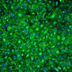 Immortalized Human Renal Glomerular Endothelial Cells