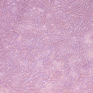 Horse Dermal Fibroblasts