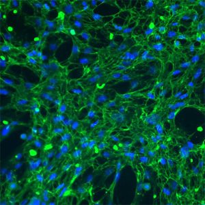 Monkey Cardiac Fibroblasts