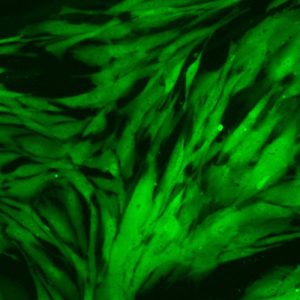 Green Fluorescent Human Colonic Fibroblasts