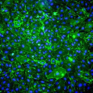 Immortalized Human Cardiac Microvascular Endothelial Cells