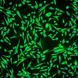 Immortalized Human Hair Dermal Papilla Cells