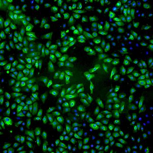 Immortalized Human Mammary Epithelial Cells