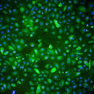 Immortalized Human Urothelial Cells