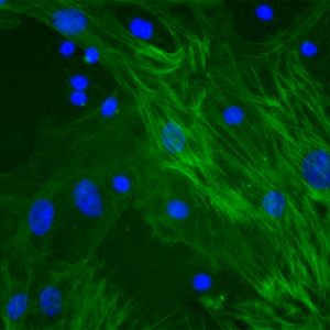 Monkey Hepatic Stellate Cells