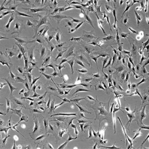 Mouse Cardiac Fibroblasts