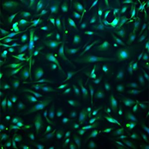 Immortalized Human Pulmonary Alveolar Epithelial Type-II Cells