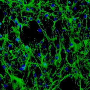 Mouse Dermal Fibroblasts