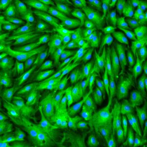 Porcine Trabecular Meshwork cells
