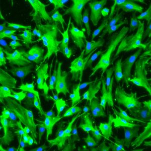 Porcine Müller Cells