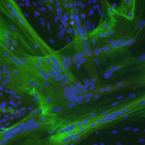 Skeletal Muscle Cell System